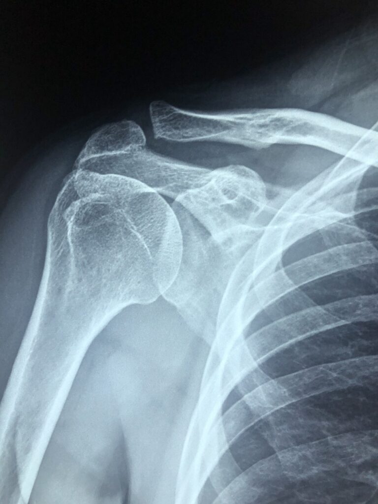 bundled payments surgical center