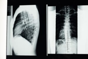 bundled payments surgical center