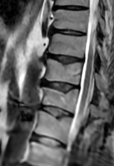 spine doctor near me