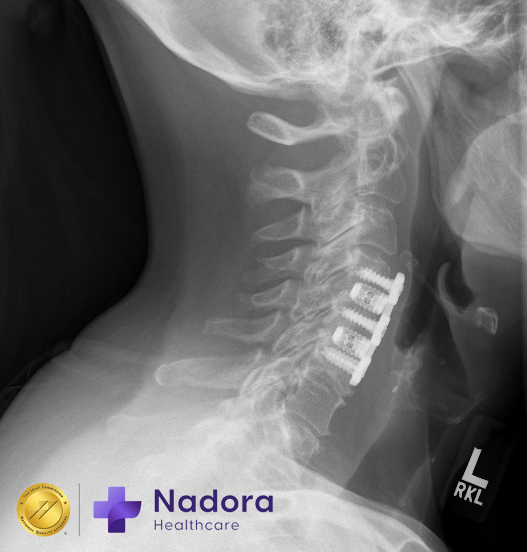 spine doctor near me