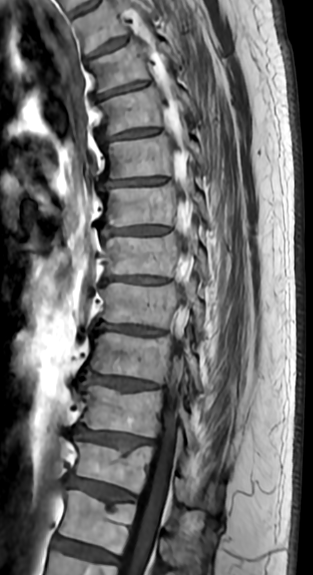 spine specialist